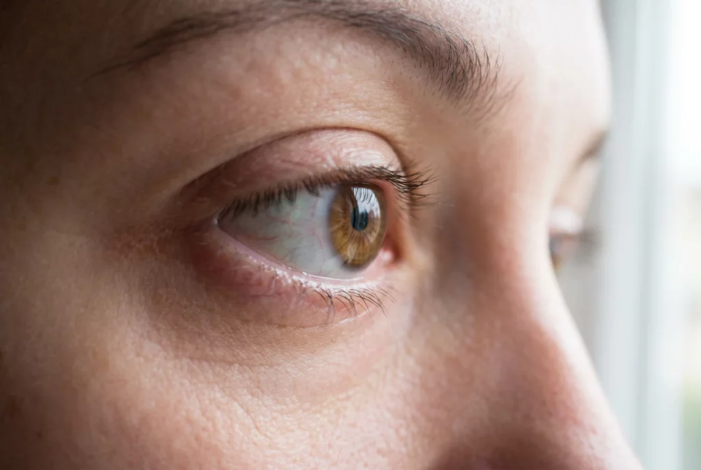 Comprendre la sécheresse oculaire